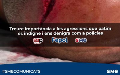 Treure importància a les agressions que patim és indigne i ens denigra com a policies